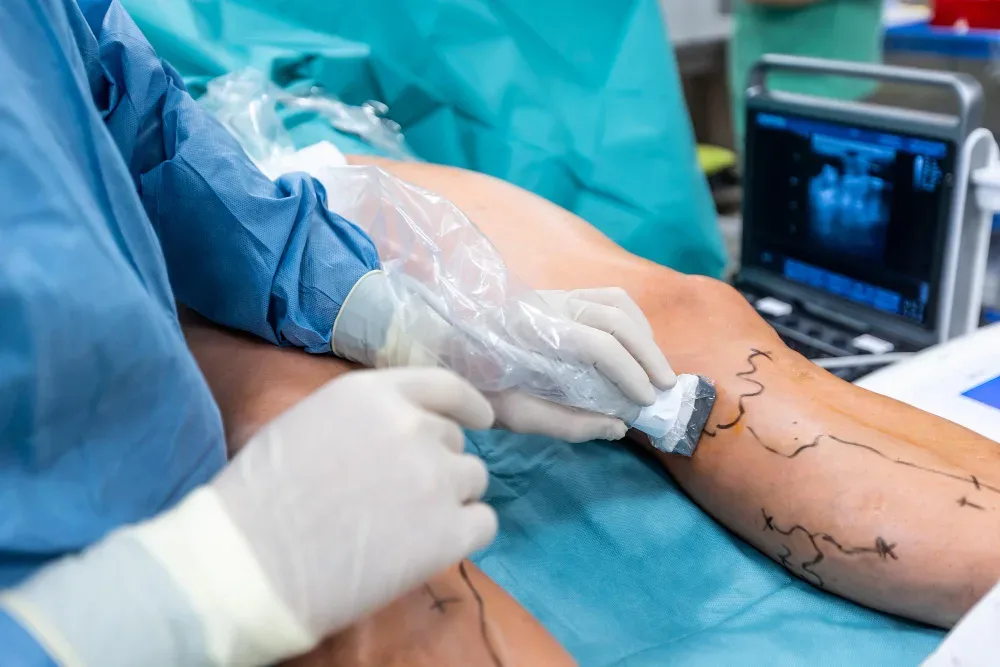 Ultrasonido Doppler Vascular